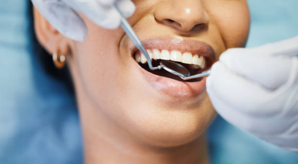 Best Root Canal Emergency Dentist  in Albany, GA